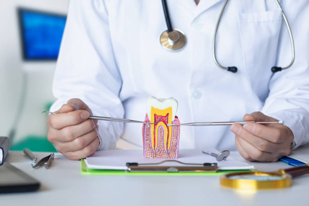 Best Knocked-Out Tooth (Avulsed Tooth) Treatment in Maryville, TN