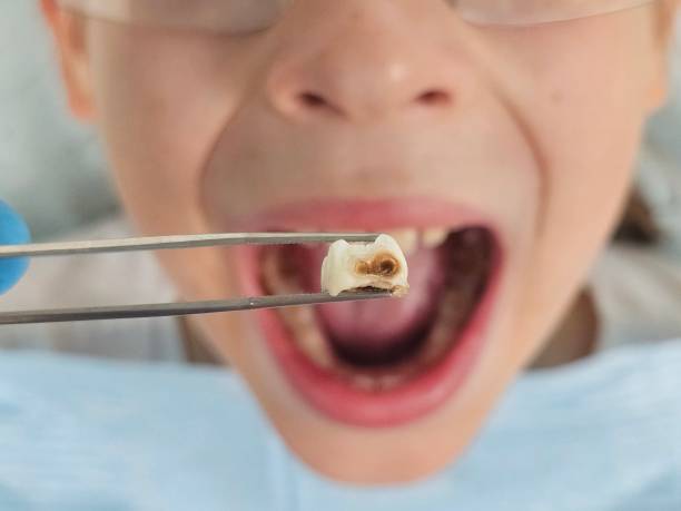 Best Walk-In Emergency Dental Services in Maryville, TN